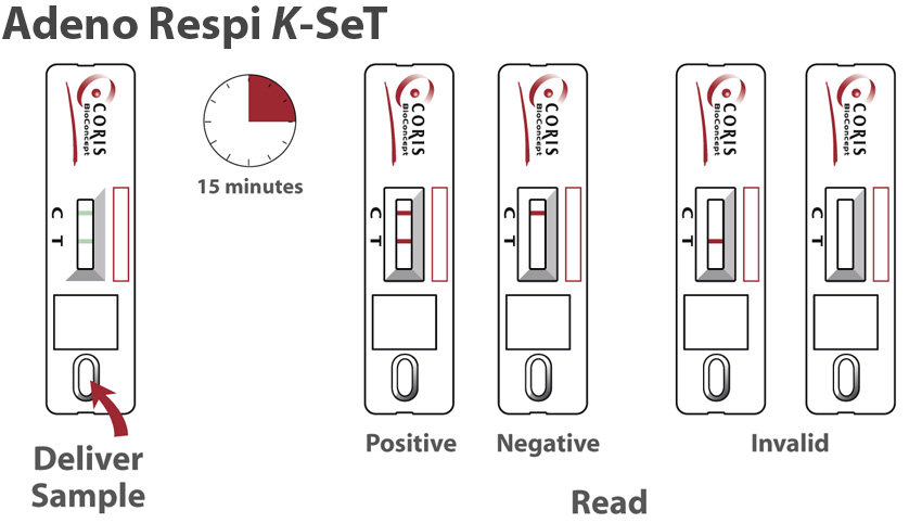 Procedure Adeno Respi K-set