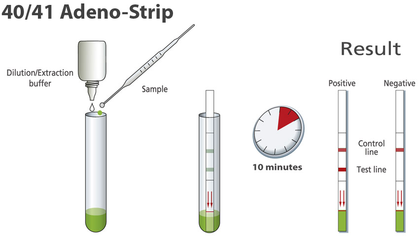 Procedure Adeno 40/41 strip