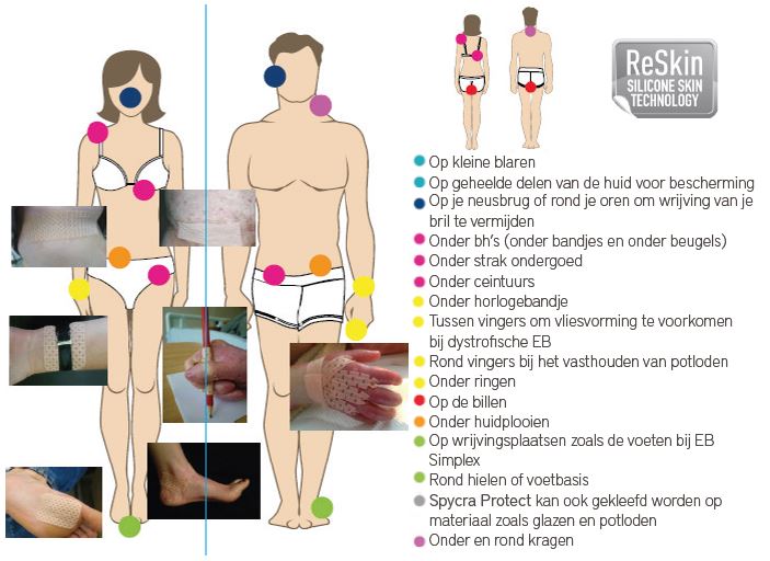 Spycra Protect toepassingen voor Epidermolysis Bullosa
