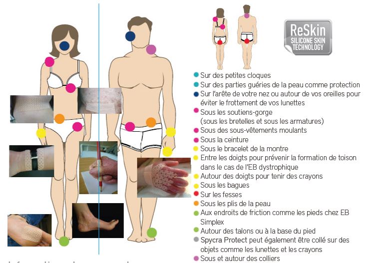 Spycra Protect applications pour Epidermolyse Bulleuse