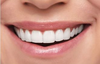 Avantages d'un traitement orthodontique