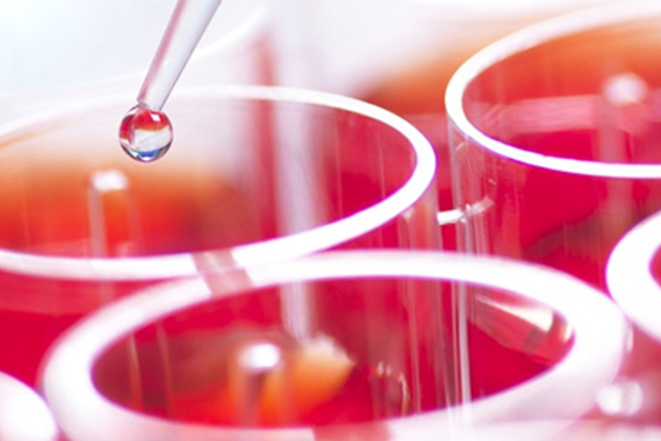 Laboratory diagnostics