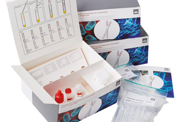 Change distribution SSI Diagnostica products