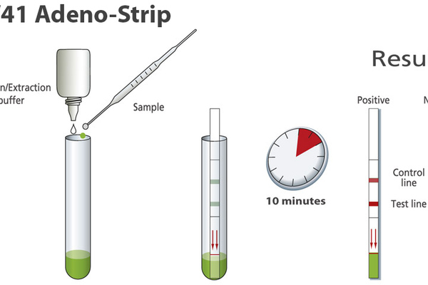 Adeno 40/41 strip