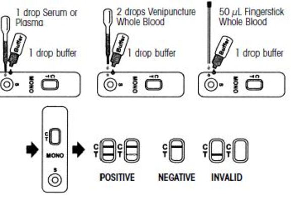 Mononucleusis Rapid Test Device