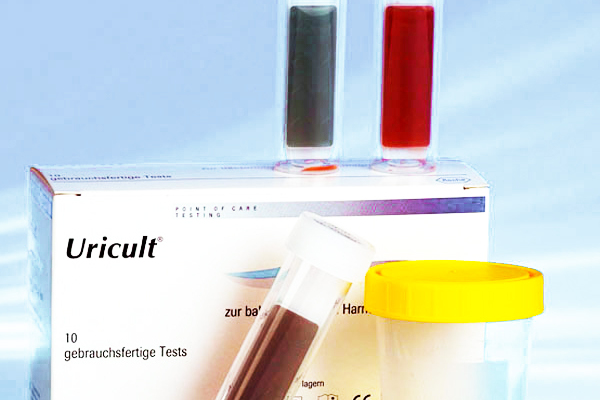 Urine dipslide