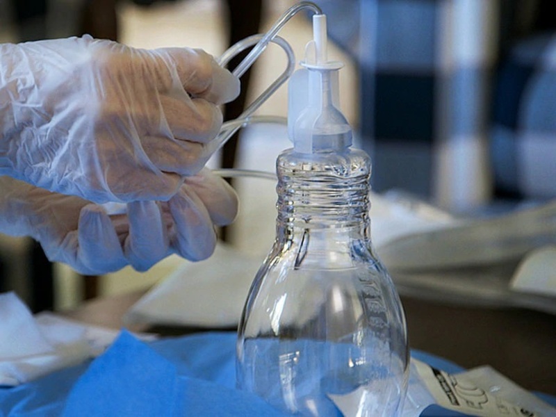 PleurX : Traitement à domicile de l’épanchement pleural et des ascites malignes