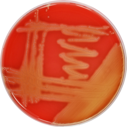 Defibrinated Sheep Blood