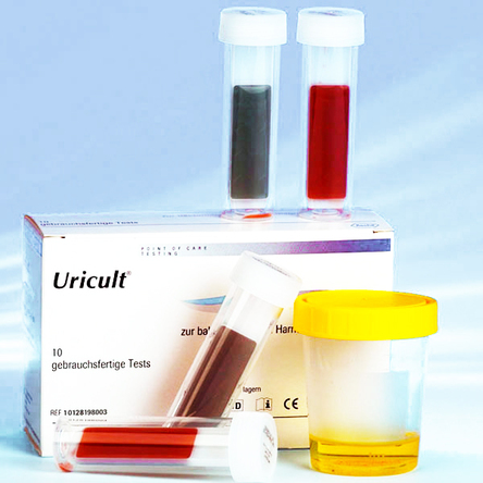 Urine dipslide