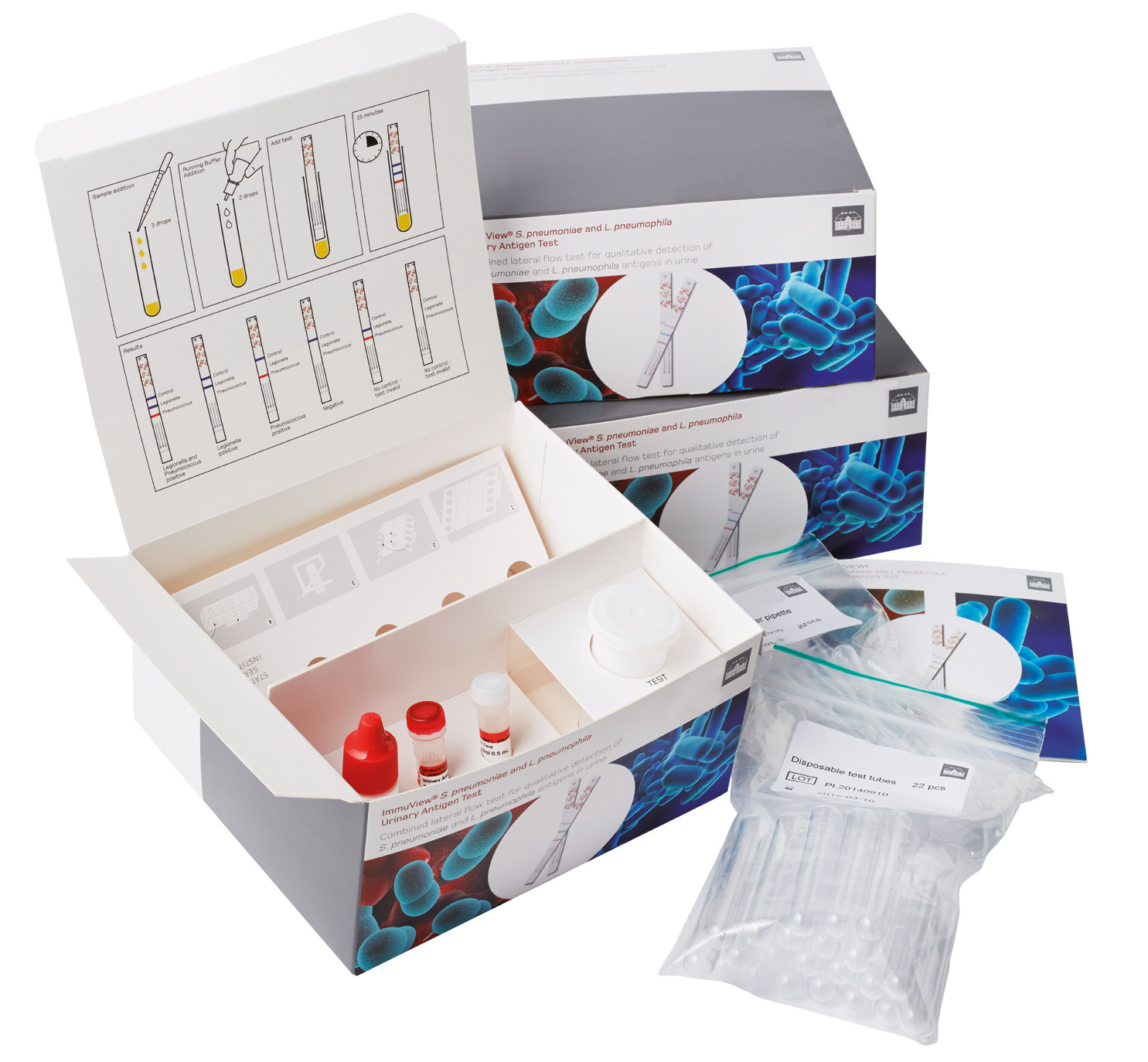 Change distribution SSI Diagnostica products